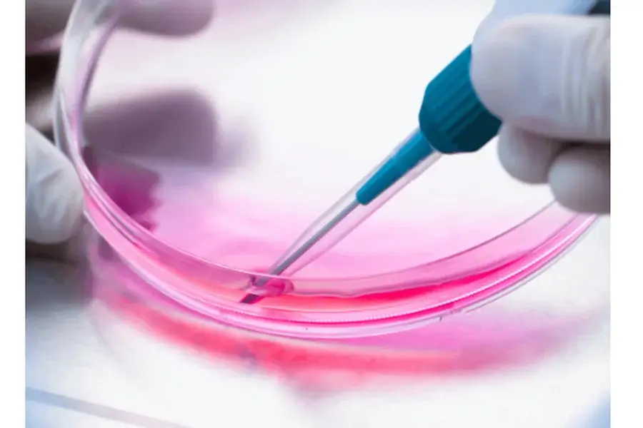 Intrathecal Injection: Safety and Best Practices Maintain strict aseptic technique and post-operative care