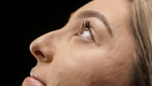 Nose Augmentation Singapore: What Results Can You Realistically Expect?