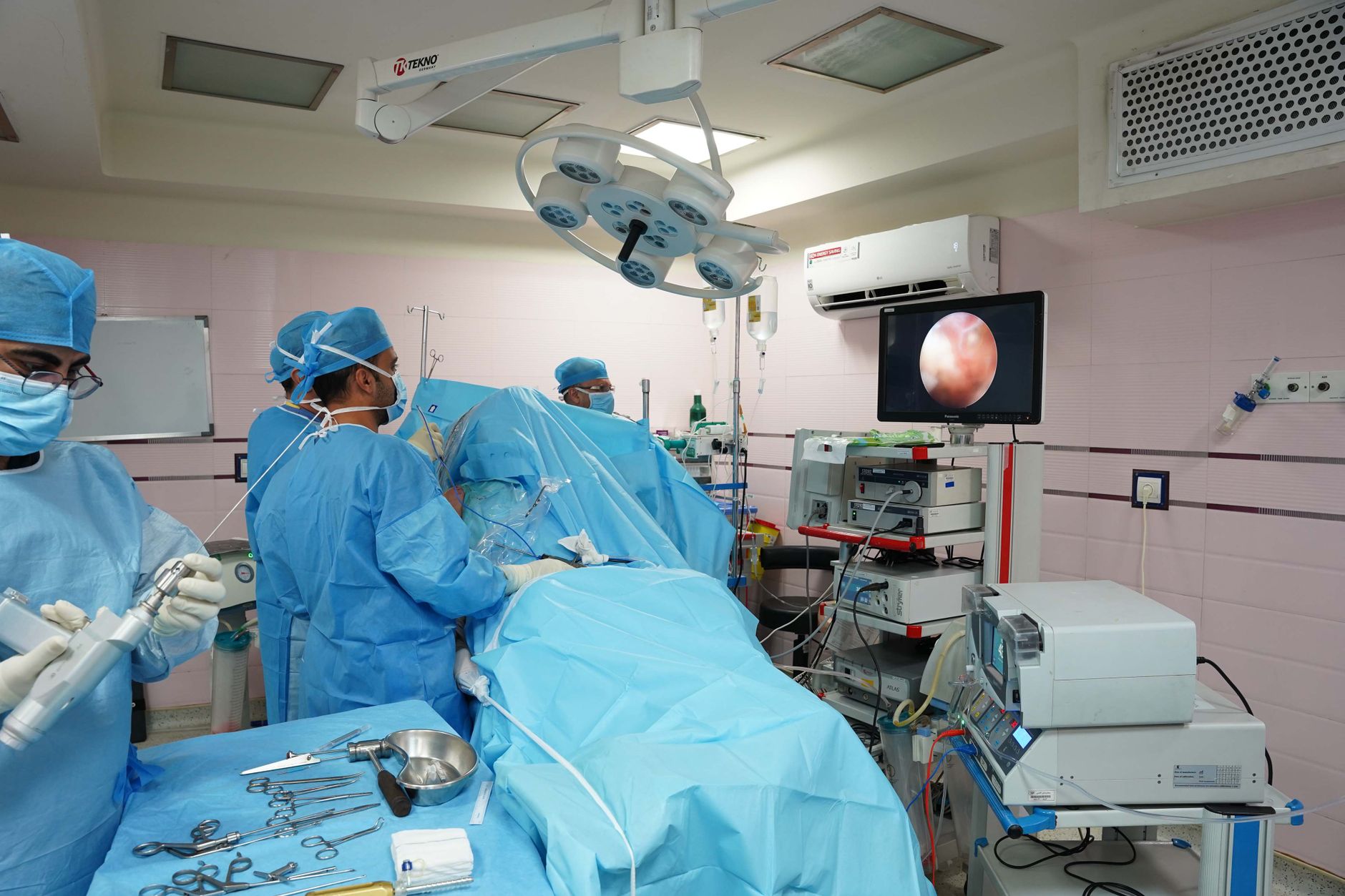 How Endoscopic Ultrasound Detects Bile Duct Stones That Other Scans May Miss