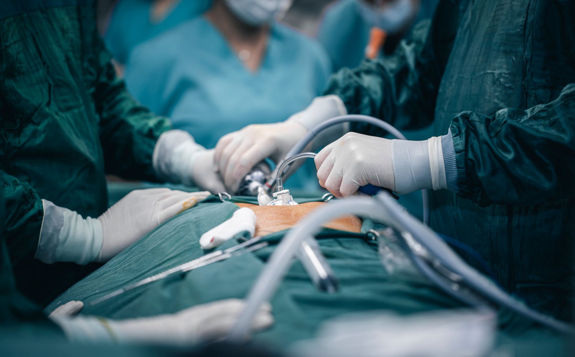 Laparoscopic Gallbladder Removal Singapore: How Does It Work?